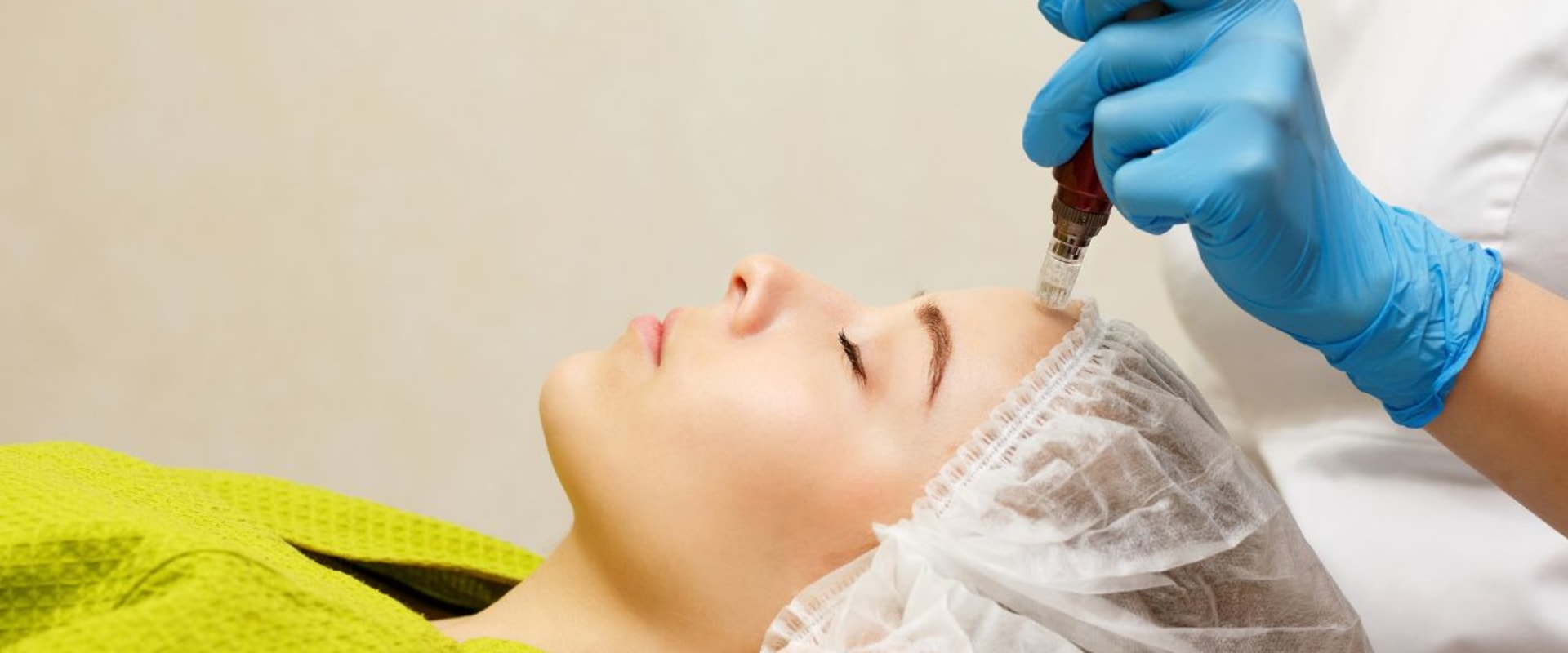 The Benefits of Microneedling: A Comprehensive Guide to Anti-Aging Treatments