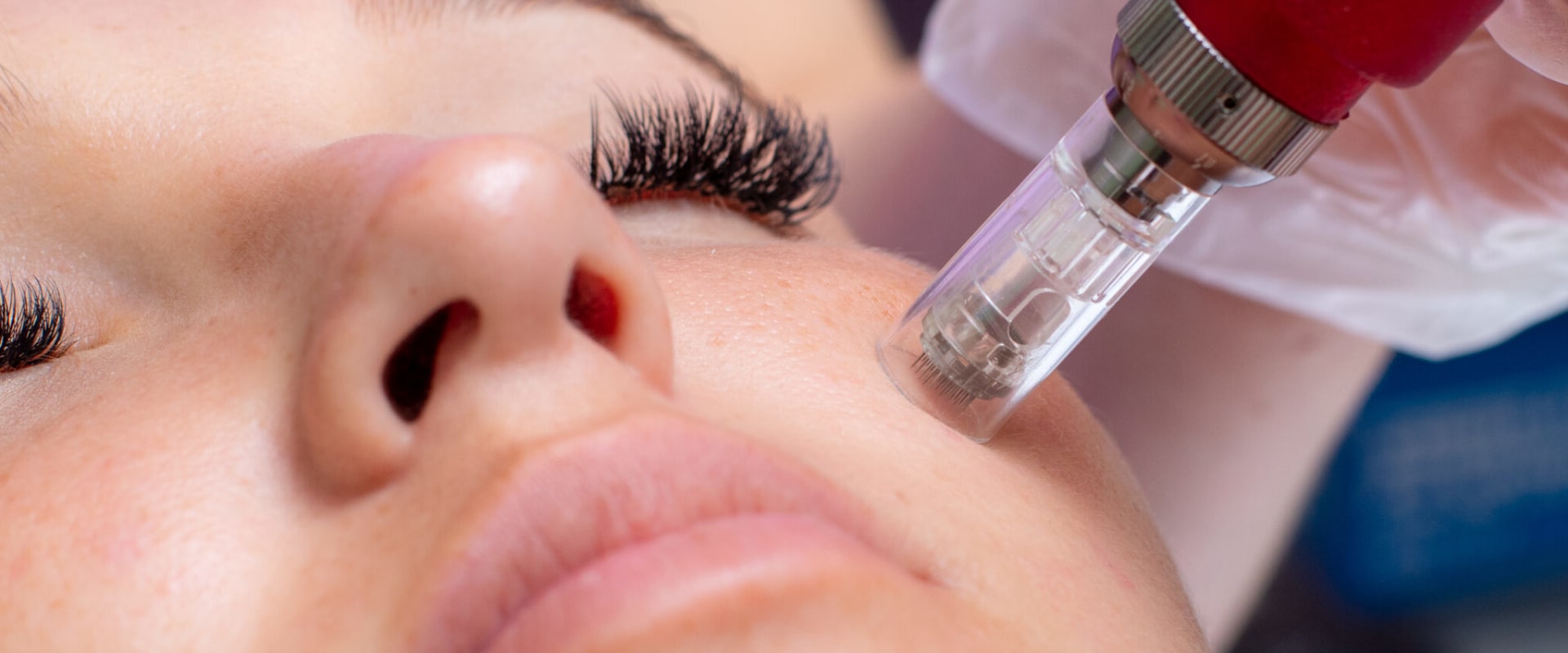 Types of Microneedling for Rejuvenation