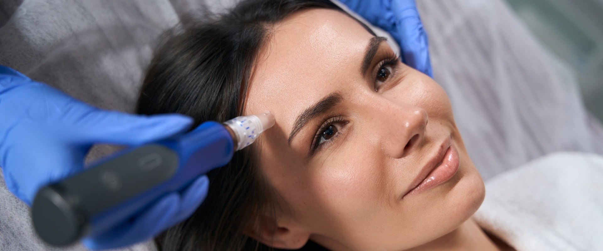 Benefits of Microneedling for Skin Rejuvenation