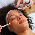 A Comprehensive Guide to Types of Chemical Peels for Medical Spas