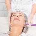 Types of Microdermabrasion: A Comprehensive Guide to Understanding the Benefits and Results