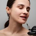 Exploring the Benefits of Botox and Fillers