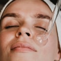 Benefits of Chemical Peels for Skin Rejuvenation