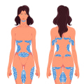 Areas That Can Be Treated With CoolSculpting