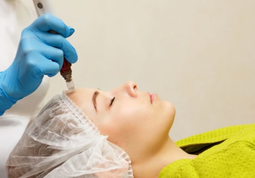 The Benefits of Microneedling: A Comprehensive Guide to Anti-Aging Treatments