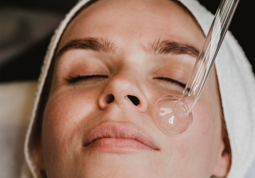 Benefits of Chemical Peels for Skin Rejuvenation