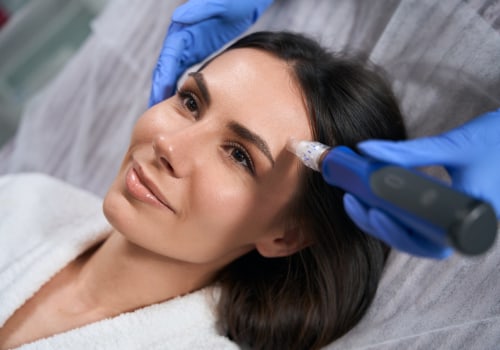 Benefits of Microneedling for Skin Rejuvenation